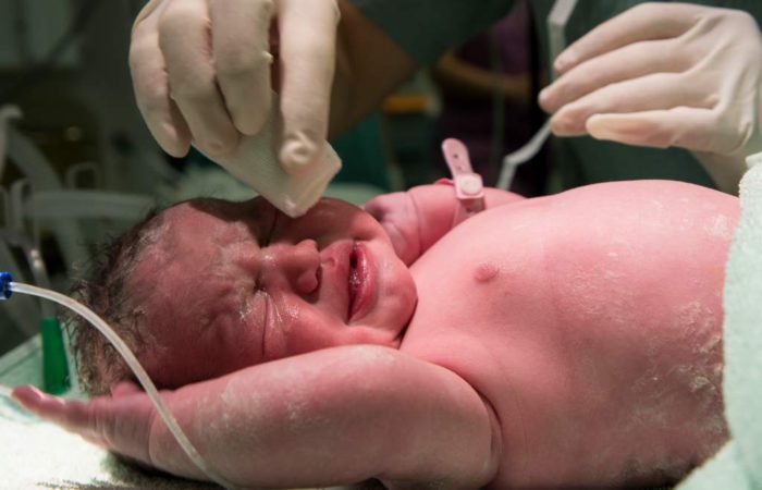 Vernix Caseosa Lapisan Pelindung Yang Bermanfaat Bagi Bayi Baru Lahir