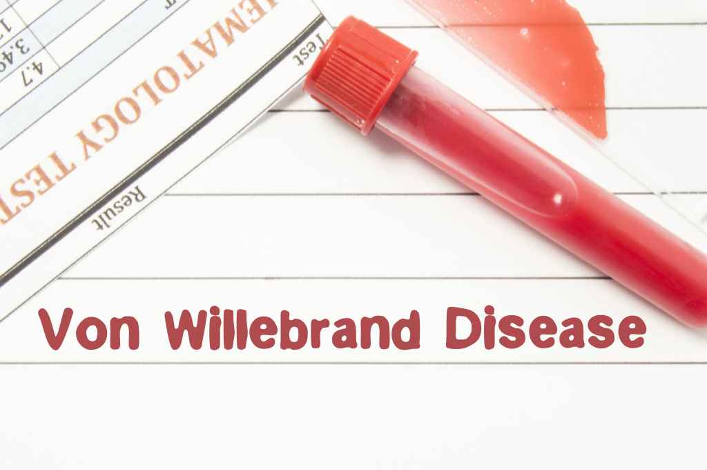 Penyakit Von Willebrand: Gejala, Penyebab, Pengobatan, dll