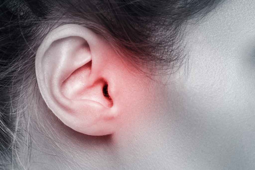 Kanker Telinga: Gejala, Penyebab, Diagnosis, dan Pengobatan