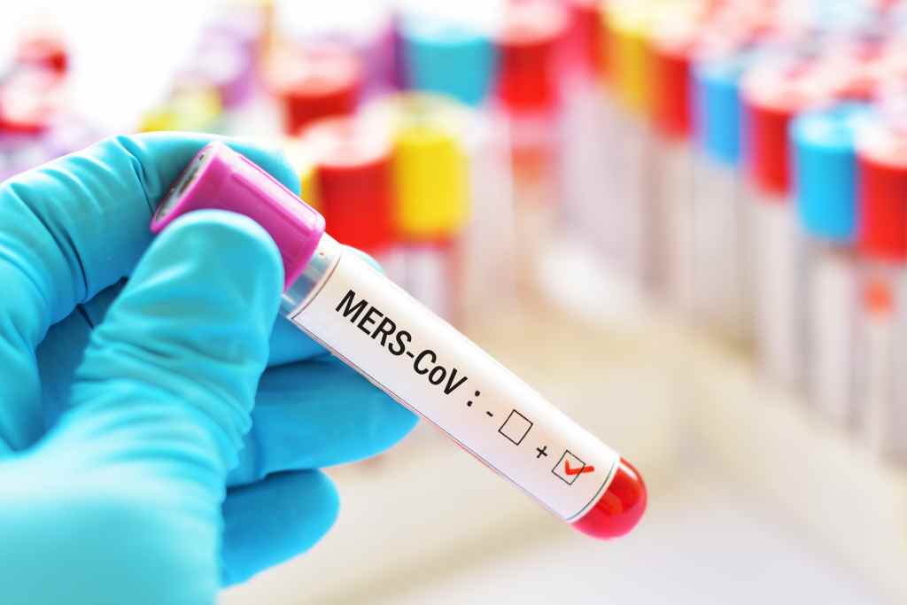 MERS: Gejala, Penyebab, Diagnosis, dan Pengobatan