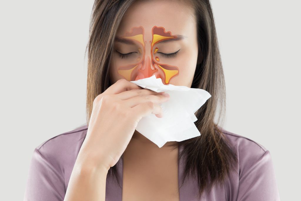 Cara Mengobati Penyakit Polip Hidung