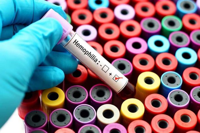 hemofilia-adalah-doktersehat