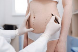 doktersehat-sedot-lemak