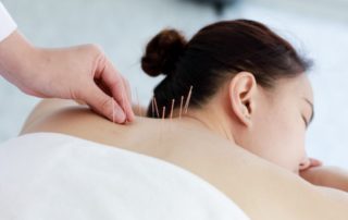 Efektifkah Terapi Akupunktur Melawan Penyakit Kanker?