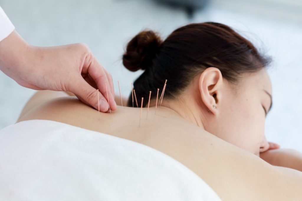 Efektifkah Terapi Akupunktur Melawan Penyakit Kanker?
