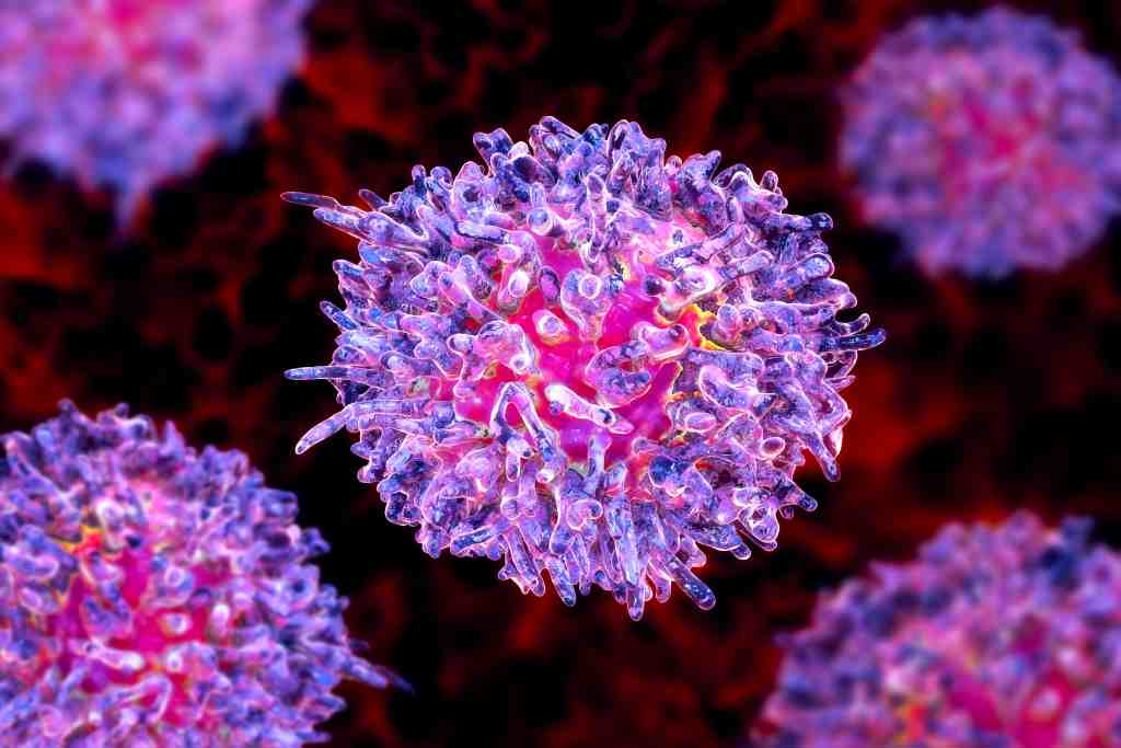 Leukemia Sel Berambut: Penyebab, Gejala, Pengobatan, dan Pencegahan