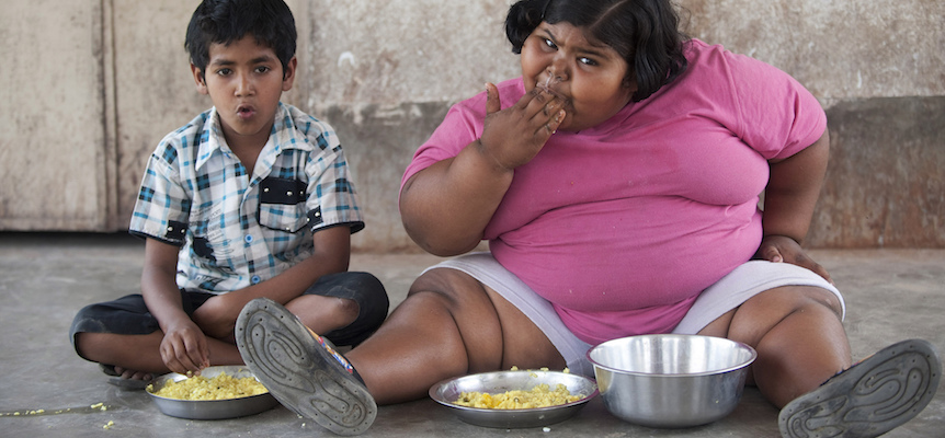 Jangan Biarkan Anak Mengalami Masalah Obesitas