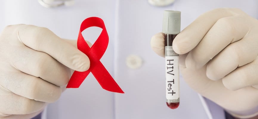 Waspadai Gejala HIV/AIDS yang Muncul pada Pria