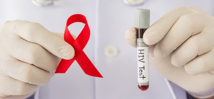Virus HIV Bisa Saja Baru Menimbulkan Masalah Kesehatan 10 Tahun Kemudian
