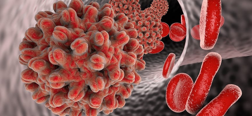 Trombositopenia – Peningkatan Kerusakan Platelet