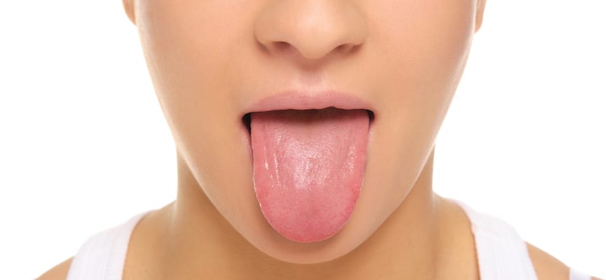 doktersehat-lidah-mulut
