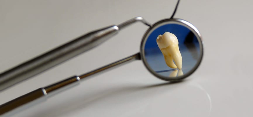 Peneliti di Inggris Menemukan Tambalan Gigi yang Bisa Dipakai Untuk Seumur Hidup