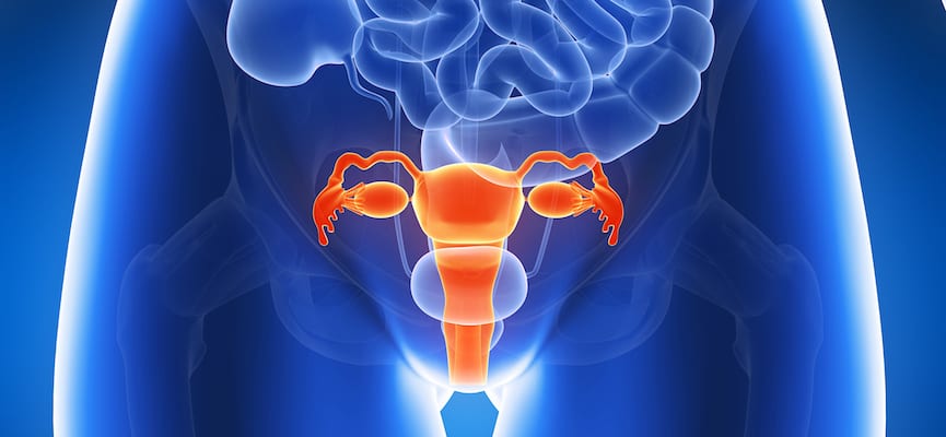 Endometriosis – Penyebab dan Risiko Kemandulan
