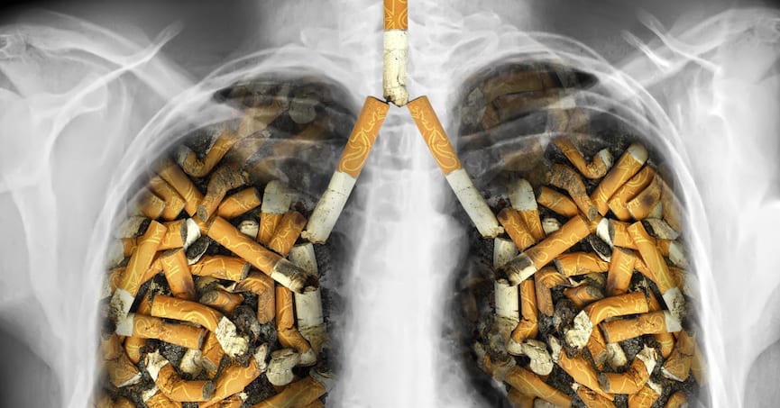 Kebiasaan Merokok Pengaruhi Struktur DNA Manusia