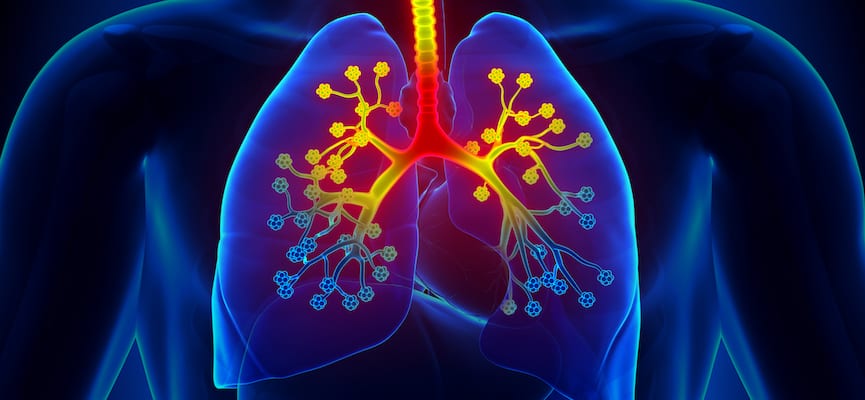 doktersehat-paru-paru-Asbestosis-Fibrosis-paru-kanker-pneumonia