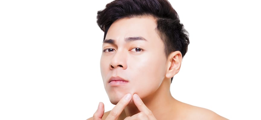 Manfaat Salicylic Acid Pada Skincare Khusus Jerawat