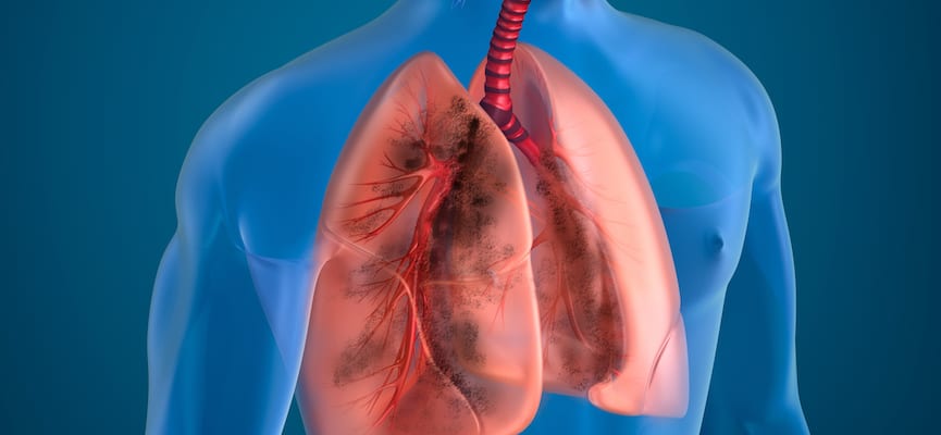 Overview Penyakit Paru pada Saluran Napas dan Kantong Udara (Alveoli)