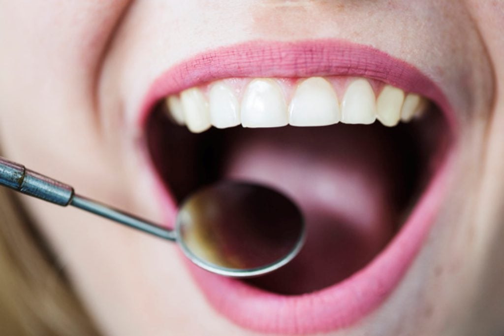 Erosi Gigi – Penyebab, Gejala, Pengobatan, & Pencegahan