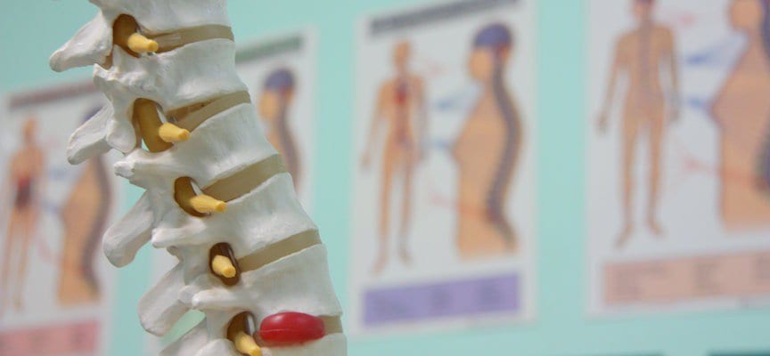 Penyakit Osteoporosis Jangan Abaikan