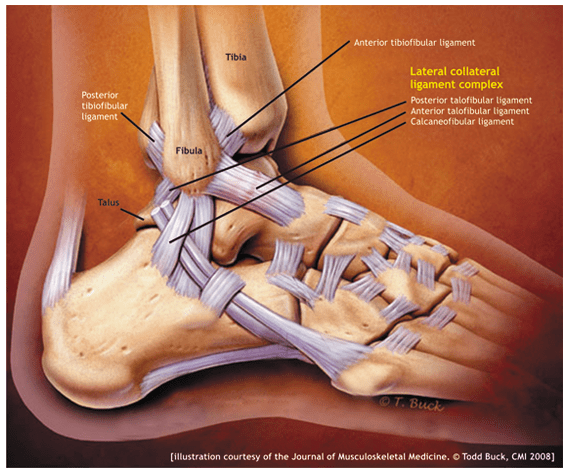 Penyebab Cedera Ankle dan Pengobatannya