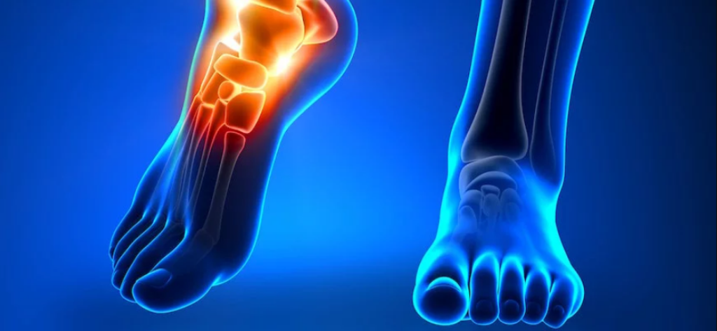 Penyebab Cedera Ankle dan Pengobatannya