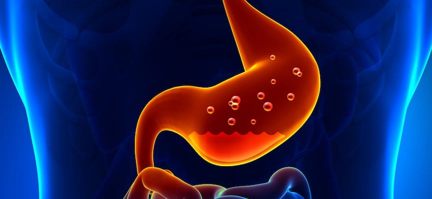Gastroesophageal Reflux Disease (GERD) – Penyebab dan Faktor yang Berpengaruh