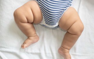 Mengenal Kriptorkidisme, Testis Tidak Turun pada Bayi Baru Lahir