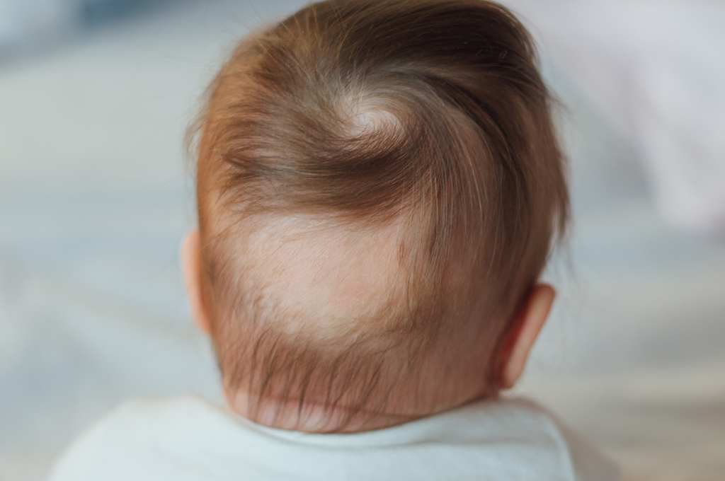 15 Penyebab Rambut Rontok Pada Anak yang Harus Diwaspadai