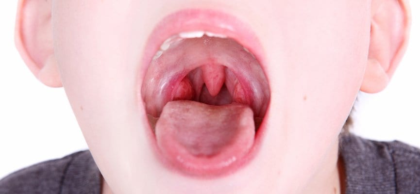 Disfungsi Plica Vocalis – Pengertian