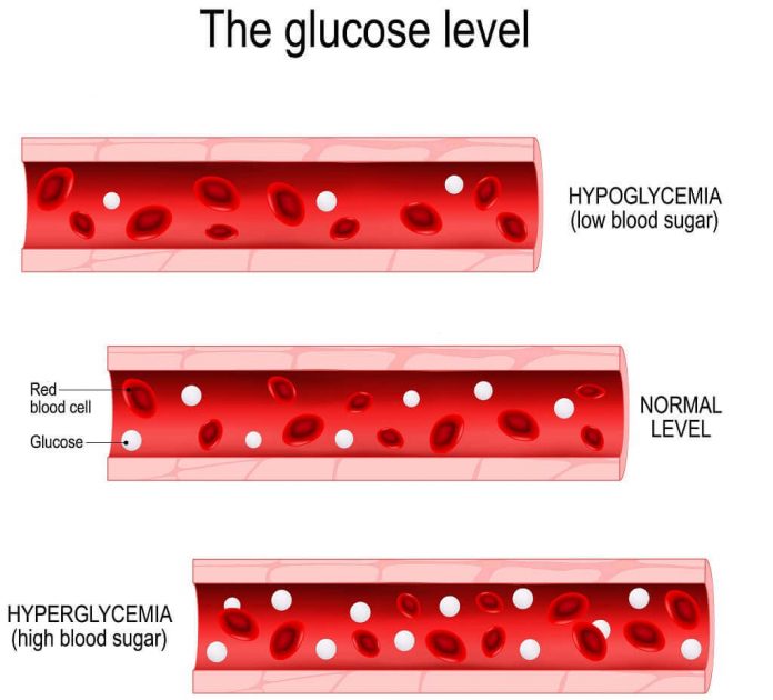 Hipoglikemia Penyebab Gejala Diagnosis Dan Penanganan