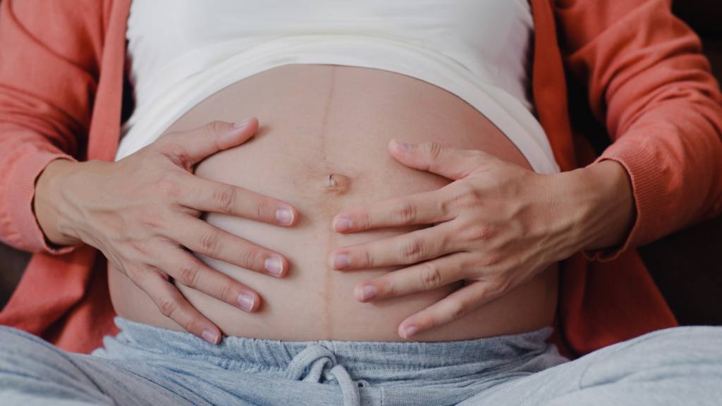 How to Handle an Umbilical Hernia in Pregnancy