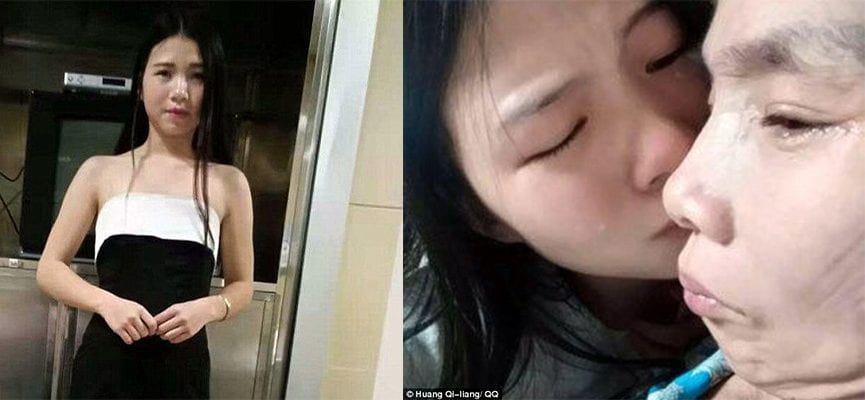 Demi Membiayai Ibunya yang Terkena Kanker Kulit, Remaja Ini Rela Jual Diri