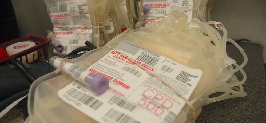 Sebelum Melakukan Donor Darah, Perhatikan Fakta-Fakta Berikut Ini