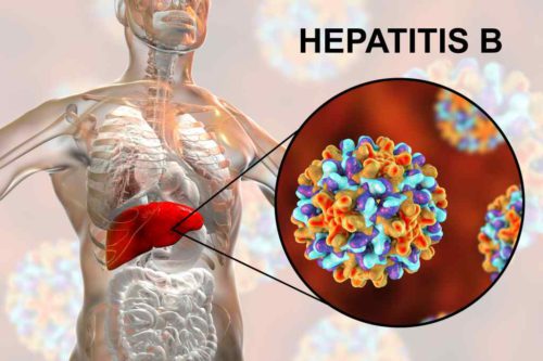 Hepatitis B: Penyebab, Gejala, Diagnosis, & Pengobatan