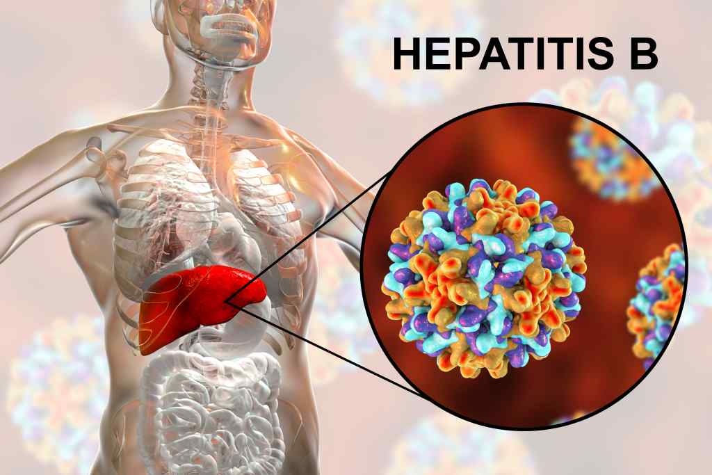 Hepatitis B: Penyebab, Gejala, Diagnosis, dan Pengobatan