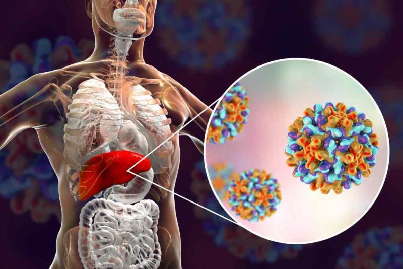 7 Penularan Hepatitis B Yang Patut Diwaspadai! - DokterSehat