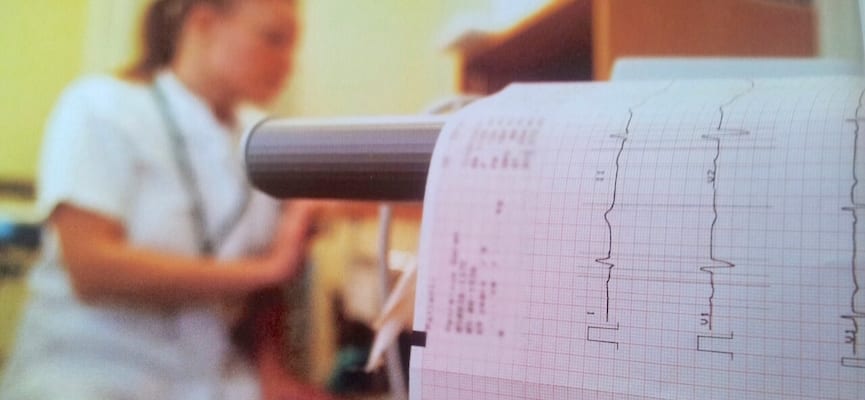 Elektrokardiogram (EKG) – Interpretasi