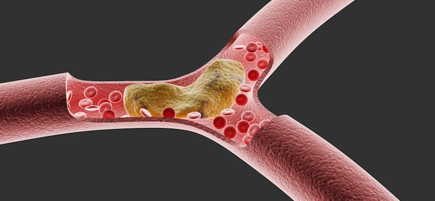 Ini Kadar Normal Kolesterol Dalam Tubuh dan Cara Menjaganya