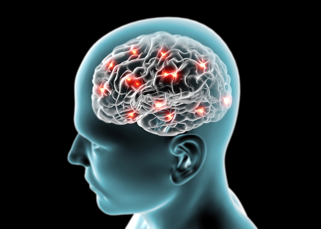 Pengobatan Cavernous Sinus Thrombosis