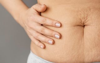 Penyebab dan Cara Atasi Perut Masih Buncit Setelah Melahirkan