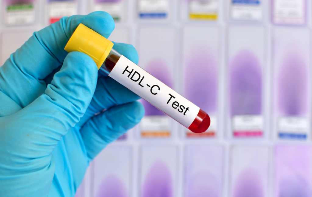 Kolesterol Baik (HDL): Cara Meningkatkan dan Menjaganya Tetap Normal