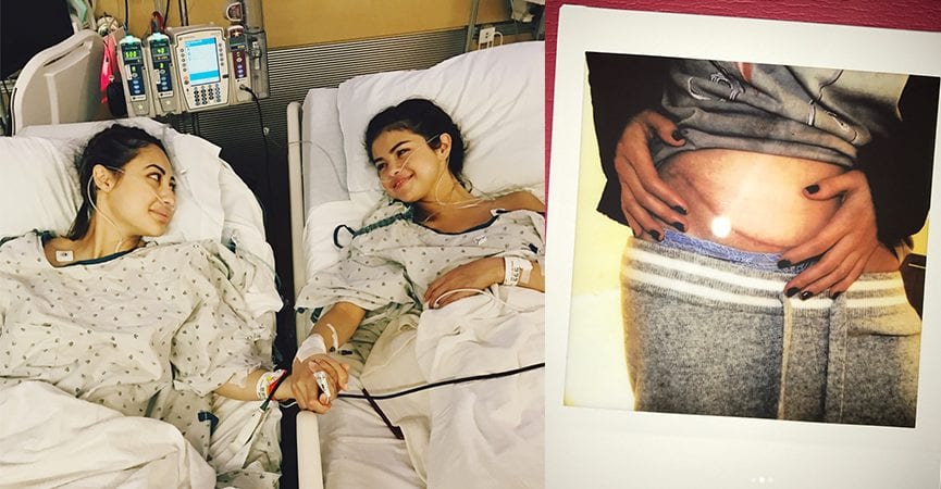 Selena Gomez Ternyata Hampir Meninggal Setelah Transplantasi Ginjal