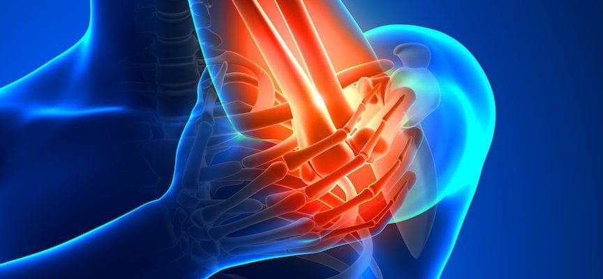 Tendinitis - Diagnosis - DokterSehat