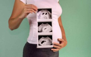 Vanishing Twin Syndrome, Ketika Bayi Kembar Hilang Dari Kandungan