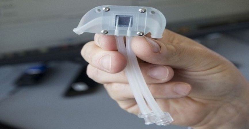 Ginjal Bionik Ini Bisa Membuat Cuci Darah Tak Lagi Perlu Dilakukan