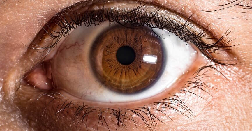 Pro Kontra Penggunaan Eyelash Extension dari Segi Kesehatan