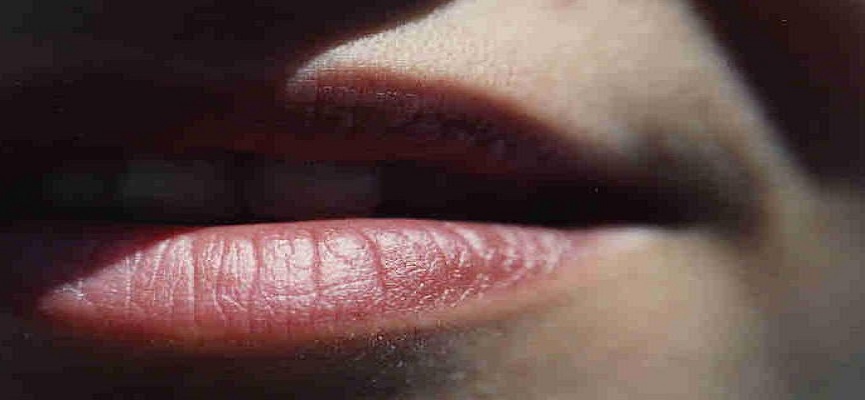 Inilah Cara Hilangkan Noda Gelap di Sekitar Bibir