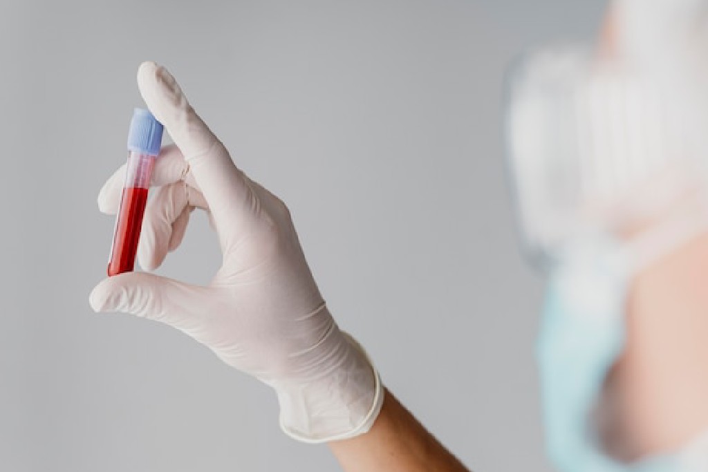 Jenis-jenis Tes Darah Bisa Dilakukan Ibu Hamil