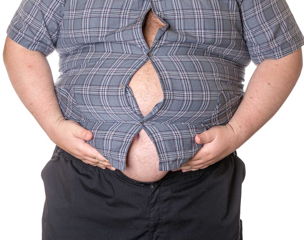 Selain Kalori, Inilah Penyebab Lain Obesitas yang Wajib Dihindari
