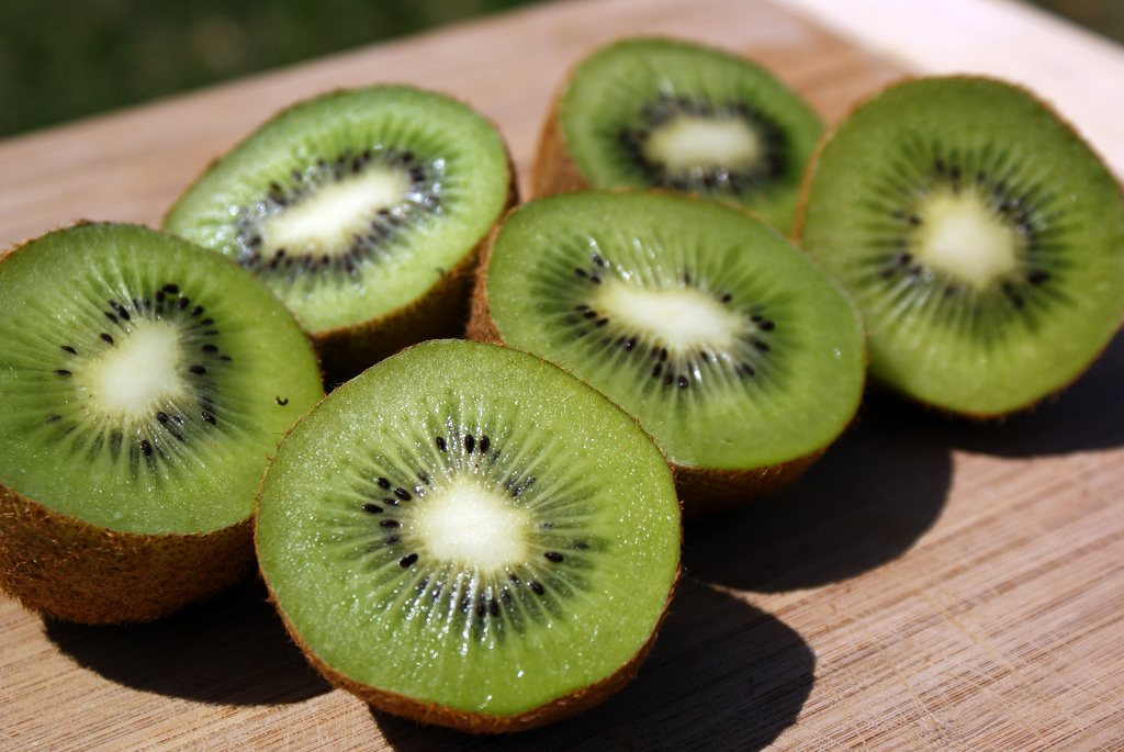 Disebut Buah Sehat, Apa Saja Sih Kandungan Gizi Kiwi?